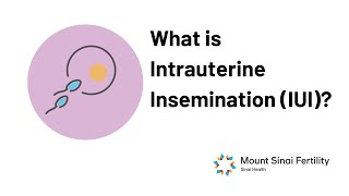 Intrauterine Insemination [upl. by Leif]