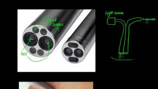 How Does an Endoscope Work  GCSE Physics [upl. by Aligna]