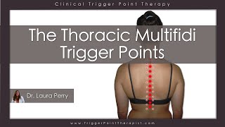 The Thoracic Multifidi Trigger Points [upl. by Eveiveneg]