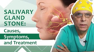 Salivary Gland Stone Causes Symptoms and Treatment Options Explained entspecialist [upl. by Ocnarf865]