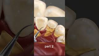 Cleaning teeth asmr video animation asmrcleaning asmr relax satysfying [upl. by Kliment]