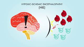 HypoxicIschemic Encephalopathy About Treatments amp Causes [upl. by Broek]