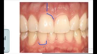 Introduction to dentistry  lecture 5 periodontics terminology [upl. by Adriana]