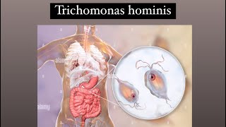 Trichomonas hominis [upl. by Coster]