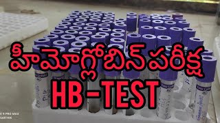 Hb test Labsrinath youtubevideos [upl. by Willa]