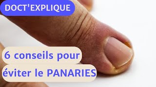 PANARIES 6 CONSEILS pour éviter cette maladie [upl. by Sikleb746]