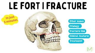 Le Fort I Fracture  Made easy in 5 minutes  Medinare [upl. by Inahc552]