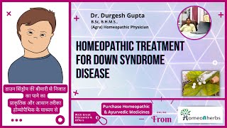 Homeopathic Treatment For Down Syndrome Desease  Homeonherbs [upl. by Kiefer549]