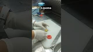 lipoma lipomatreatment [upl. by Kapoor70]