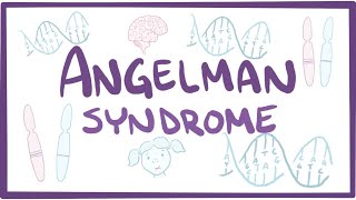 Angelman syndrome  causes symptoms diagnosis treatment pathology [upl. by Mcclish720]