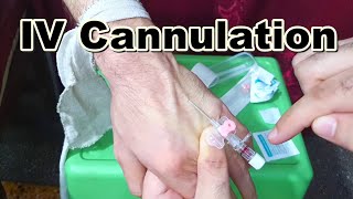 How to Insert IV Cannula  IV Cannulation Technique  Branula  Intravenous Catheter [upl. by Shaylynn]