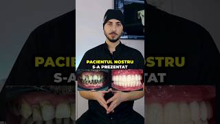 Refacerea Danturii pe Implanturi Dentare implantdentar implant doctor dentist transformare [upl. by Ecnedurp106]