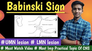 Babinski signUpper and Lower motor neuron lesion CNS Physiology Ashish Agrawal [upl. by Elita]