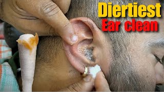 Dirtiest Ear Cleaning amp Ear Wax removal Head Massage by  Shamboo Barber  Asmr Ear Cleansing [upl. by Torbart734]