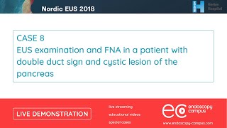 Livedemo  Nordic EUS 2018  EUS examination and FNA n a patient with double duct sign [upl. by Gurevich]