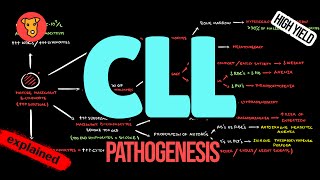 CHRONIC LYMPHOCYTIC LEUKEMIA Pathogenesis CLL Criteria Diagnosis Treatment [upl. by Chaudoin]