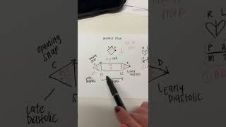 MURMUR MAN FOR CARDIAC MURMURS MNEMONIC [upl. by Arluene]