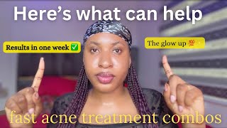 HOW TO GET RID OF ACNE FAST  treatment for acne acnetreatment facecare [upl. by Anwahsat556]