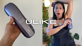 IPL Hair Removal Device on BrownDarker skin  ULIKE Air 10 [upl. by Ajtak]