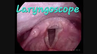 Laryngoscopy and stroboscope to examine the vocal cords  laryngoscope vocal test medical [upl. by Airdnalahs158]