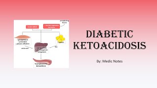 Diabetic ketoacidosis  causes signs and symptoms diagnostic criteria investigations treatment [upl. by Fiona]