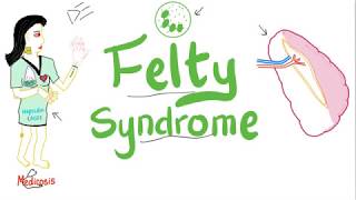 Felty Syndrome  The infamous Triad  Rheumatology [upl. by Strang]