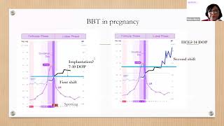 Tracking Your Basal Body Temperature  BBT Basics with Monica NFP Instructor [upl. by Laval469]