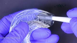 Injection moulding technique with GC Exaclear Gaenial Universal Injectable [upl. by Eissim]