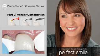 PermaShade LC Veneer Cementation Video [upl. by Asit59]