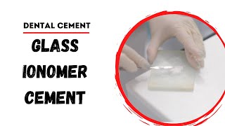 Glass Ionomer Cement  Dental Cements [upl. by Adlihtam]