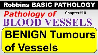 Ch10  Benign Tumours of Vessels  Blood Vessel Pathology  Robbins Lectures [upl. by Steve759]