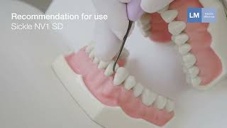 How to use Sickle NV1 SD LM™ hand instrument [upl. by Eachern]