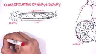 Neurology  Nerve Damage and Regeneration [upl. by Saunders132]