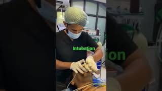 endotracheal intubation [upl. by Enitsenre235]