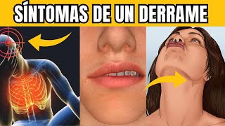 7 SÍNTOMAS de un ACV Derrame Cerebral antes de que OCURRA [upl. by Imim]