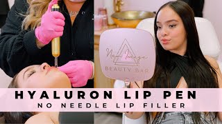 Lip Filler Without Needles Hyaluron Lip Pen Treatment [upl. by Iztim]