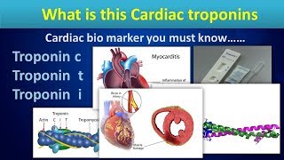 What is this Cardiac troponinsCardiac bio markers in Myocardial ischemia [upl. by Neeneg]