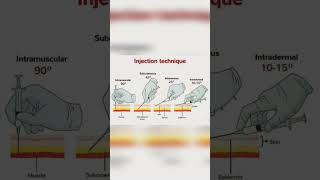 Injection technique doctor injection medicalstudent ytshorts [upl. by Rudman876]