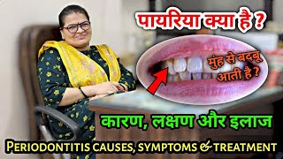 पायरिया क्या है  कारण लक्षण और इलाज । pyriya periodontitis causes symptoms amp treatment [upl. by Sobel]