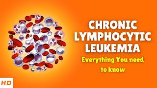 Chronic Lymphocytic Leukemia – Causes Signs and Symptoms Diagnosis amp Treatment [upl. by Dnyletak]