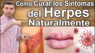 Cómo Curar y Tratar El Herpes Naturalmente [upl. by Ahcrop626]