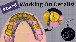 Expert In Design  Working On Details  Smile Design [upl. by Hsirrehc344]