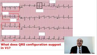 EKG Trainer Case 2  Question [upl. by Nailimixam]