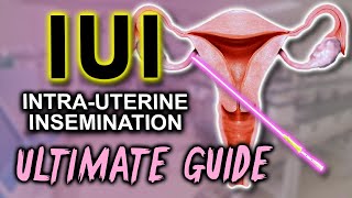 IUI  Fertility expert secrets for maximum pregnancy rates [upl. by Eddana804]