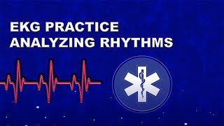 Test Yourself  EKG Rhythm Analysis [upl. by Crescantia43]