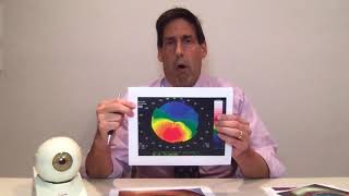 What is Keratoconus and how to treat it  Dr Alan Mendelsohn [upl. by Aydin]