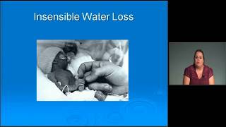 Neonatal Intensive Care Exam Review Electrolyte Disturbances  MEDED [upl. by Ludovico655]