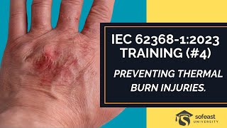 IEC 6236812023 Training Part 4 Preventing Thermal Burn Injuries [upl. by Toffey968]