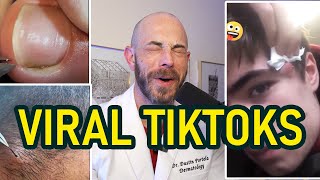 Dermatologists JawDropping Reaction to Amazing Pimple Pops [upl. by Azerila10]