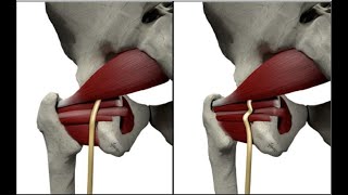 Sciatic Nerve Dynamic Ultrasound  Includes Obturator Gemellus Piriformis Quadratus Femoris [upl. by Brynne]